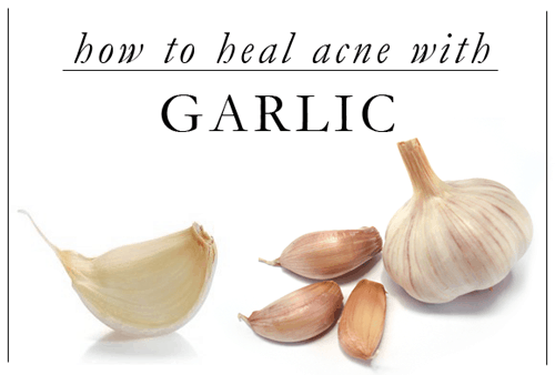5 Surprising ways to use garlic.  Garlic is so cheap and plentiful everyone should use these!